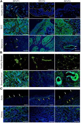 Evaluation of Riboflavin Transporters as Targets for Drug Delivery and Theranostics